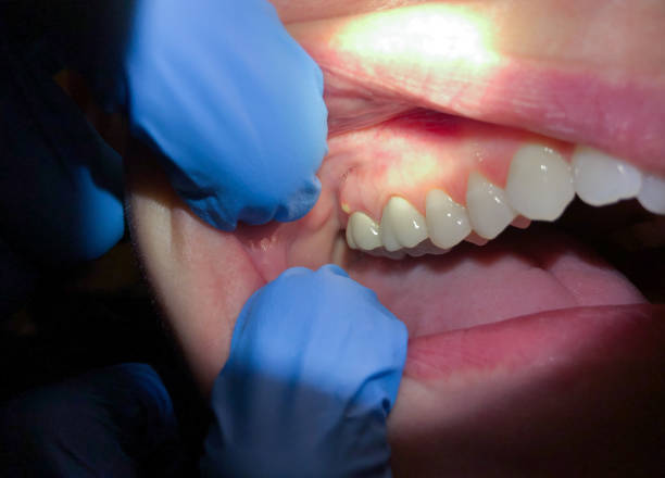 Best Cosmetic Emergency Dentistry in Princeton, NJ