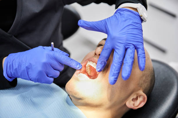 Best Emergency Wisdom Teeth Removal in Princeton, NJ